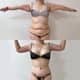 Slider image (9) Dr. Gabriel Sandoval - Plastic Surgeon in Mexico